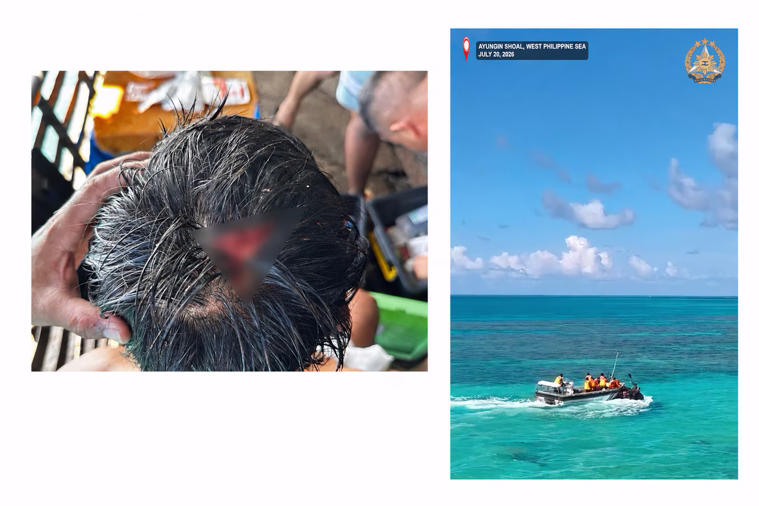 負傷した比海軍職員（左）、小型艇上でオールのようなものを振り回す中国海警職員（右）