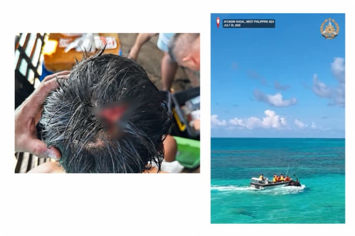 負傷した比海軍職員（左）、小型艇上でオールのようなものを振り回す中国海警職員（右）